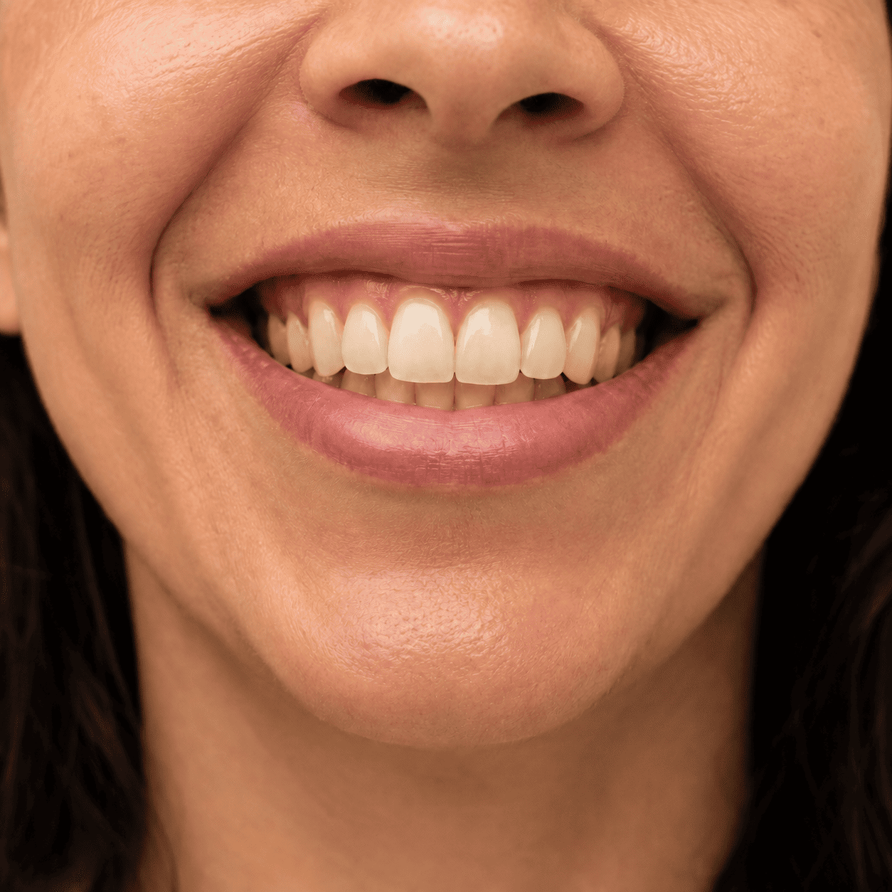 Sorriso natural antes da escova&ccedil;&atilde;o demonstrativa